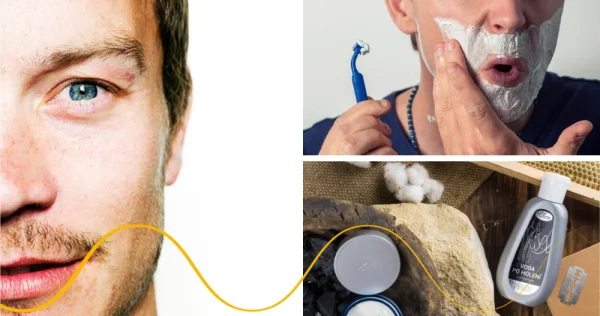 Ingrown hair? We have a few tips! Let us go into the bathroom!