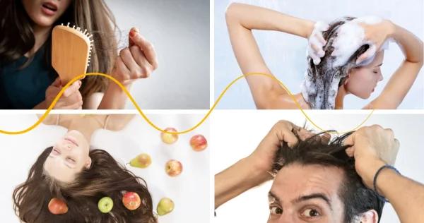 Alopecia or why does my hair keep falling out?
