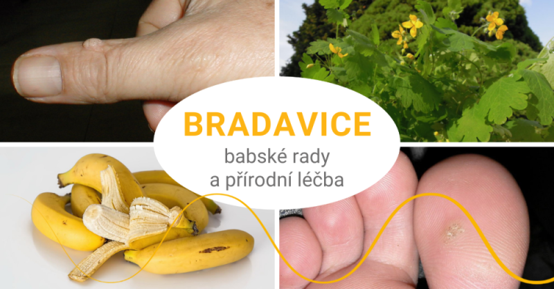 Bradavice: co s nimi?