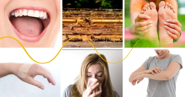 Propolis Tincture - Experience of Use