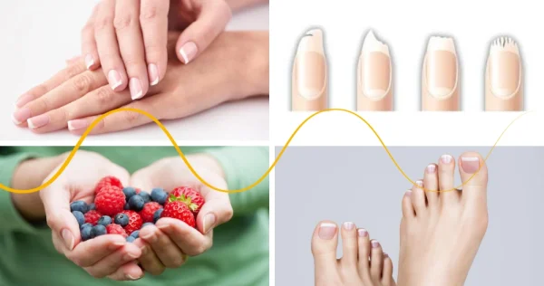 Healthy Nails without Fungus, Breakage, or Ingrowth
