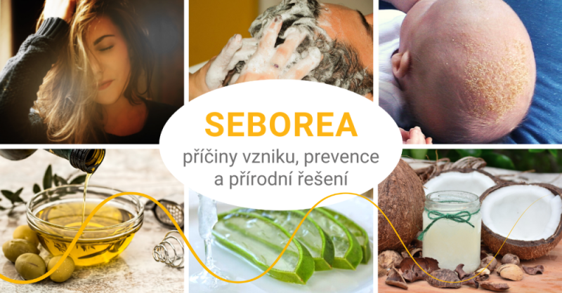 Seborea – příčiny vzniku, prevence a přírodní řešení