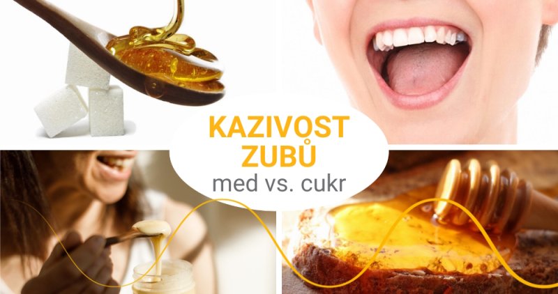 Kazí se vám zuby? Může za to cukr, nikoli med!