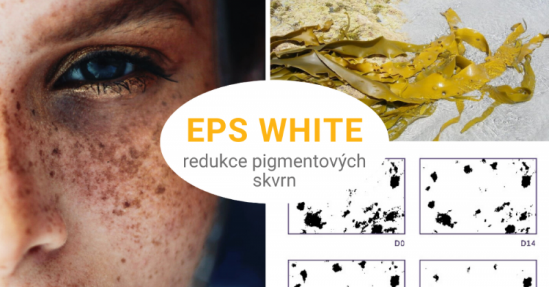 Odstranění pigmentových skvrn: EPS White