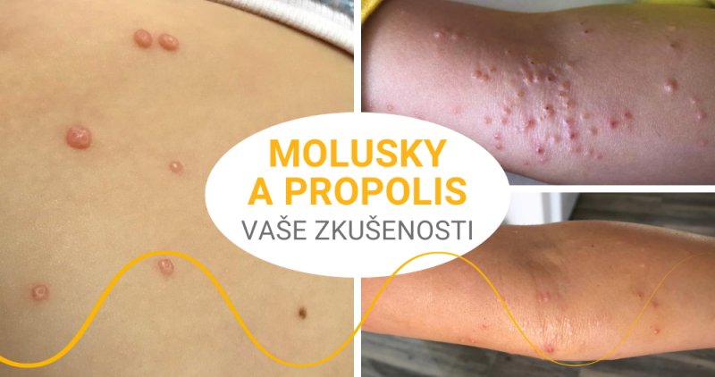 Propolis a molusky - zkušenosti našich zákazníků