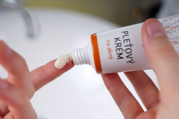 Acne clearing lotion and acne cream