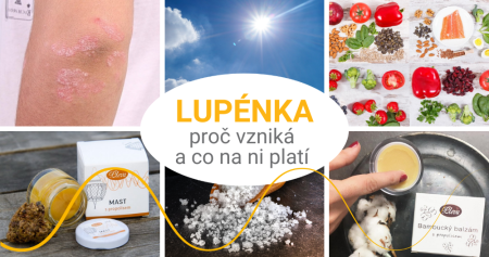 Lupénka – proč vzniká a jaké jsou možnosti léčby