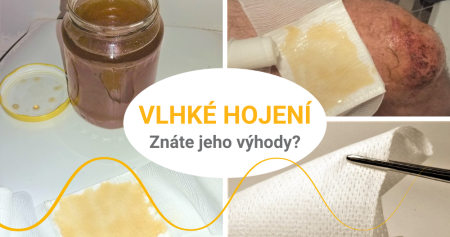 Vlhké hojení ran: pochvalují si ho (nejen) sestřičky v nemocnicích. Znáte jeho výhody?