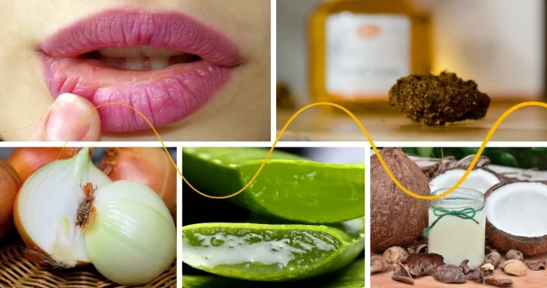 Aphthae – how they develop, natural remedies, treatment with herbs