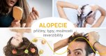 Alopecie aneb Proč mi pořád padají vlasy?