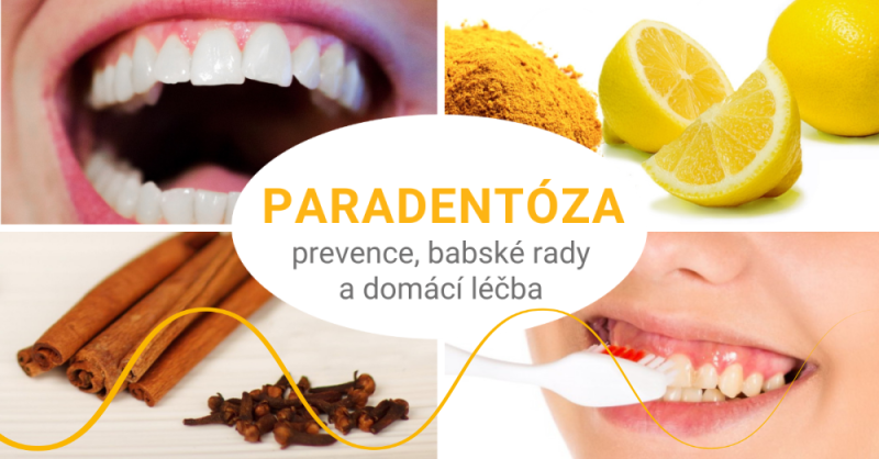 Paradentóza: příznaky, prevence, domácí léčba i babské rady