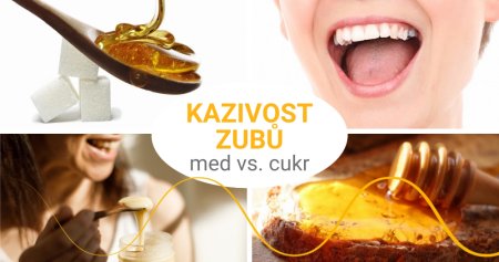 Kazí se vám zuby? Může za to cukr, nikoli med!
