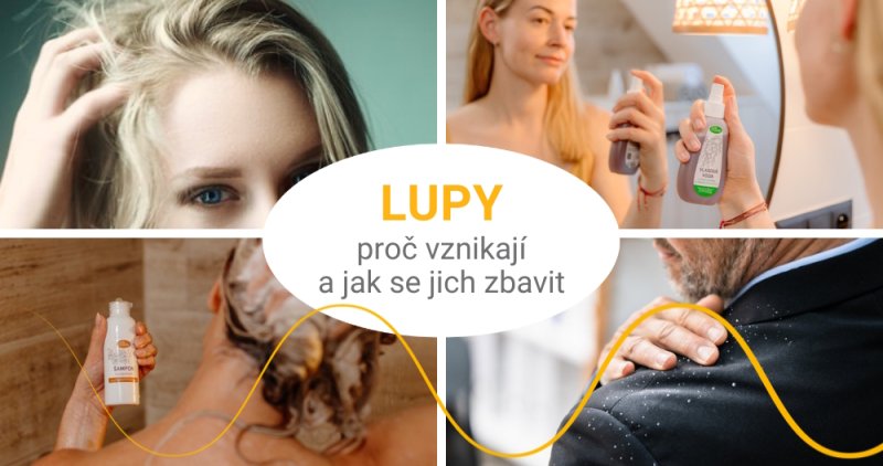 Lupy ve vlasech - proč vznikají a jak se jich zbavit