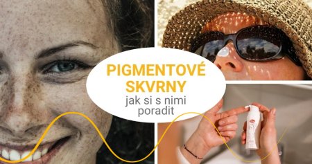 Poraďte si s pigmentovými skvrnami nejen od slunce