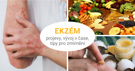 Ekzém trápí malé děti i překvapené dospělé