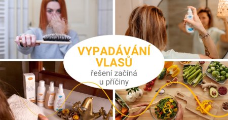 Vypadávání vlasů