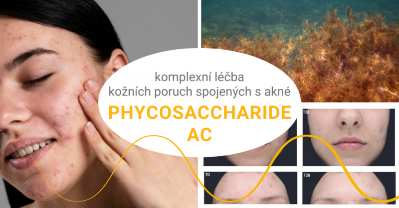 Komplexní léčba kožních poruch spojených s akné - PHYCOSACCHARIDE AC